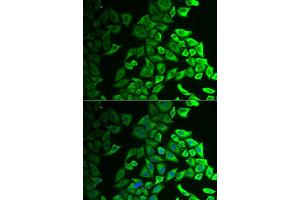 Immunofluorescence analysis of A549 cell using IL18BP antibody. (IL18BP antibody)