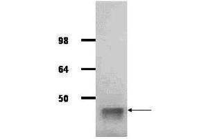 IgG purified antibody to rabbit muscle aldolase (100-1141, 200-1141 and 200-1341) was used at a 1:1000 dilution to detect human aldolase by western blot. (Aldolase antibody  (HRP))