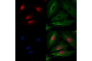 ABIN6259505 and ABIN6275797 staining  cells by IF/ICC. (CHFR antibody  (Internal Region))
