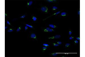 Immunofluorescence of purified MaxPab antibody to GOLM1 on HeLa cell. (GOLM1 antibody  (AA 1-401))