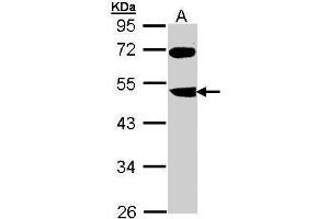 WB Image Sample (30 ug of whole cell lysate) A: Molt-4 , 10% SDS PAGE antibody diluted at 1:1000 (FBXL3 antibody)