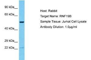 Host: Rabbit Target Name: RNF19B Sample Tissue: Human Jurkat Whole Cell Antibody Dilution: 1ug/ml (RNF19B antibody  (C-Term))