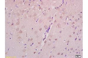 Formalin-fixed and paraffin embedded rat brain tissue labeled with Anti Axin 2 Polyclonal Antibody,Unconjugated (ABIN713696) at 1:200 followed by conjugation to the secondary antibody and DAB staining. (AXIN2 antibody  (AA 331-430))