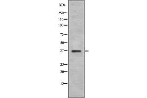 Western blot analysis GS28 using K562 whole cell lysates (GS28 antibody  (Internal Region))