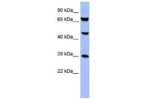 WB Suggested Anti-SNRPB Antibody Titration:  0. (SNRPB antibody  (N-Term))