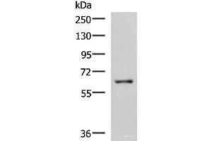 Western blot analysis of HepG2 cell lysate using LILRB5 Polyclonal Antibody at dilution of 1:600 (LILRB5 antibody)
