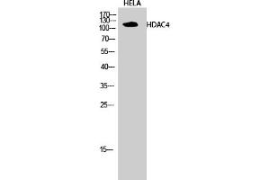 Western Blotting (WB) image for anti-Histone Deacetylase 4 (HDAC4) (Ser632) antibody (ABIN5956852) (HDAC4 antibody  (Ser632))