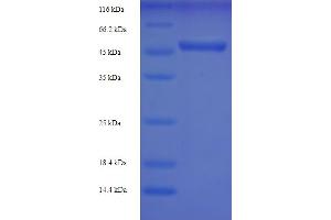 SDS-PAGE (SDS) image for Ubiquitin Carboxyl-terminal Hydrolase L5 (UCHL5) (AA 1-326), (Isoform 4) protein (His-SUMO Tag) (ABIN5710589)
