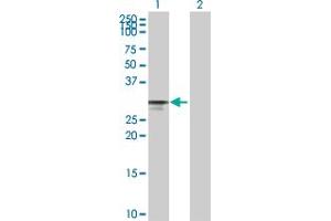 Western Blot analysis of CDK4 expression in transfected 293T cell line by CDK4 MaxPab polyclonal antibody. (CDK4 antibody  (AA 1-303))