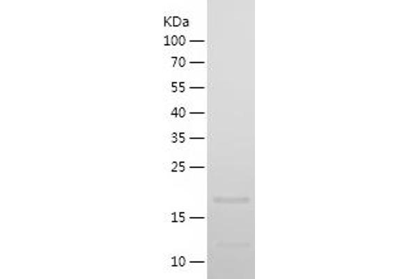 MYLPF Protein (AA 1-169) (His tag)