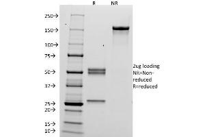 SDS-PAGE Analysis Purified hCG alpha Mouse Monoclonal Antibody (HCGa/53). (CGA antibody)