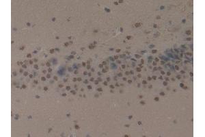 IHC-P analysis of Rat Brain Tissue, with DAB staining. (Cytokeratin 1 antibody  (AA 489-625))