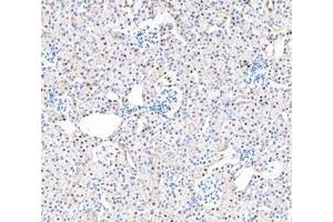 IHC analysis of ADK using anti-ADK antibody (ABIN4886430). (ADK antibody  (AA 165-351))