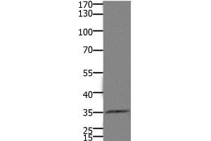 Western Blot analysis of Mouse kidney tissue using HOXD11 Polyclonal Antibody at dilution of 1:1100 (HOXD11 antibody)