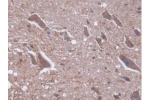 IHC-P analysis of Rat Spinal cord Tissue, with DAB staining. (PKC delta antibody  (AA 347-601))