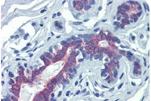 Breast, Human: Formalin-Fixed, Paraffin-Embedded (FFPE) (LIMD1 antibody  (N-Term))