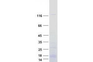 Western Blotting (WB) image for DEAH (Asp-Glu-Ala-His) Box Polypeptide 30 (DHX30) (Transcript Variant 2) protein (Myc-DYKDDDDK Tag) (ABIN2719460)