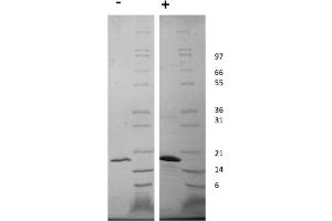 SDS-PAGE of Human Fibroblast Growth Factor-22 Recombinant Protein SDS-PAGE of Human Fibroblast Growth Factor-22 Recombinant Protein.