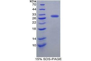 SDS-PAGE (SDS) image for Dopamine Receptor D2 (DRD2) (AA 194-421) protein (His tag) (ABIN2124666)