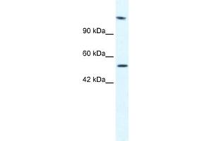 WB Suggested Anti-HELB Antibody Titration:  2. (DNA Helicase B antibody  (N-Term))