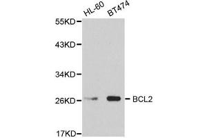 Western Blotting (WB) image for anti-B-Cell CLL/lymphoma 2 (BCL2) antibody (ABIN1876758) (Bcl-2 antibody)