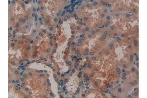 Detection of MMP12 in Human Kidney Tissue using Polyclonal Antibody to Matrix Metalloproteinase 12 (MMP12) (MMP12 antibody  (AA 290-469))