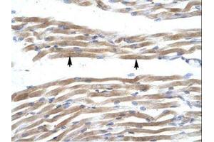Image no. 1 for anti-Fatty Acid Binding Protein 3, Muscle and Heart (FABP3) (AA 46-95) antibody (ABIN202026) (FABP3 antibody  (AA 46-95))