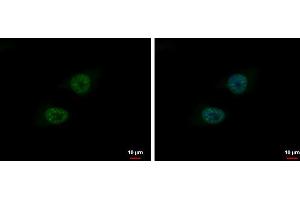 ICC/IF Image BLM antibody [N1N2], N-term detects BLM protein at nucleus by immunofluorescent analysis. (BLM antibody  (N-Term))