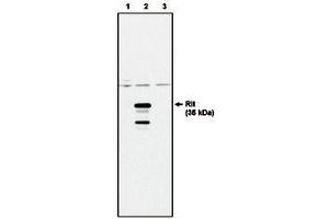 Image no. 1 for anti-Ras-Like Without CAAX 1 (RIT1) antibody (ABIN201609) (RIT1 antibody)