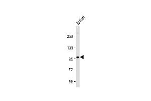 Anti-PI3KR1 Antibody (N-term L11) at 1:2000 dilution + Jurkat whole cell lysate Lysates/proteins at 20 μg per lane. (PIK3R1 antibody  (N-Term))