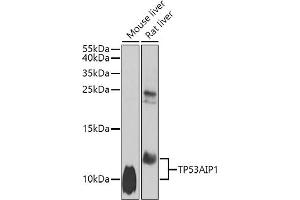 Western blot analysis of extracts of various cell lines, using TP53 antibody (ABIN6130605, ABIN6149411, ABIN6149413 and ABIN6223058) at 1:1000 dilution. (TP53AIP1 antibody  (AA 1-108))