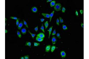 Immunofluorescent analysis of PC-3 cells using ABIN7169873 at dilution of 1:100 and Alexa Fluor 488-congugated AffiniPure Goat Anti-Rabbit IgG(H+L) (SNRPD1 antibody  (AA 1-119))