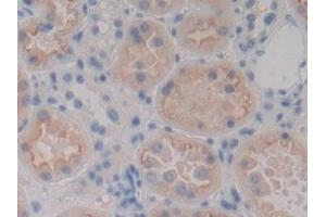 Immunohistochemistry (IHC) image for anti-Mannan-Binding Lectin Serine Peptidase 1 (MASP1) (AA 20-447) antibody (ABIN7434299)