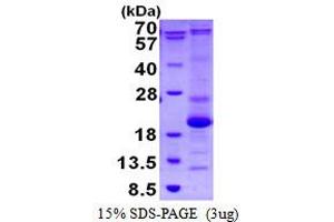 ASF1 Anti-Silencing Function 1 Homolog B (ASF1B) protein (His tag)