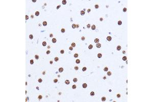 Immunohistochemistry (IHC) image for anti-Matrin 3 (MATR3) (AA 747-847) antibody (ABIN7268415)