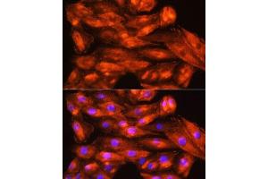 Immunofluorescence analysis of H9C2 cells using ZCCHC11 Rabbit pAb (ABIN6128939, ABIN6150406, ABIN6150407 and ABIN6221650) at dilution of 1:100.