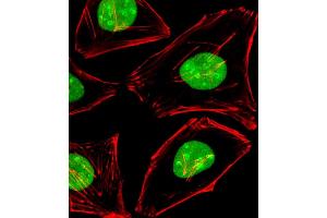 Immunofluorescent analysis of 4 % paraformaldehyde-fixed, 0. (EWSR1 antibody  (C-Term))