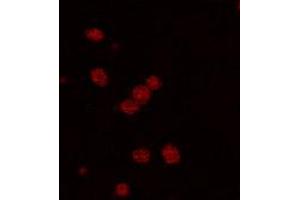 Immunofluorescence staining of PDE2A expressing cell with PDE2A polyclonal antibody . (PDE2A antibody  (C-Term))