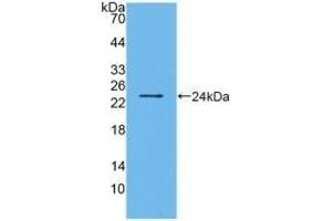 Detection of Recombinant BMF, Human using Polyclonal Antibody to Bcl2 Modifying Factor (BMF) (BMF antibody  (AA 1-181))