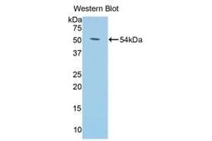 Detection of Recombinant Klotho, Mouse using Polyclonal Antibody to Klotho (KL) (Klotho antibody  (AA 59-508))