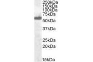 Image no. 1 for anti-Interferon Regulatory Factor 5 (IRF5) (C-Term) antibody (ABIN374255) (IRF5 antibody  (C-Term))