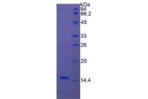SDS-PAGE of Protein Standard from the Kit (Highly purified E. (Caspase 3 ELISA Kit)