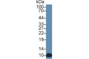 Detection of S100A12 in Human Leukocyte lysate using Monoclonal Antibody to S100 Calcium Binding Protein A12 (S100A12) (S100A12 antibody  (AA 1-92))