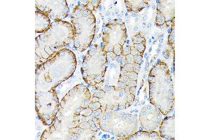 Immunohistochemistry of paraffin-embedded mouse kidney using SLC22/OCT3 Rabbit mAb (ABIN7269107) at dilution of 1:100 (40x lens). (SLC22A3 antibody)