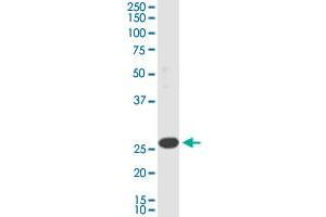 TMEM179B monoclonal antibody (M01), clone 3G8. (TMEM179B antibody  (AA 1-219))