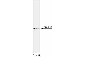 Western blot analysis of Cytokeratin 7. (Cytokeratin 7 antibody)