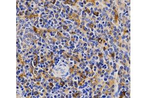 Immunohistochemistry of paraffin-embedded Rat spleen using CDK20 Polyclonal Antibody at dilution of 1:200 (40x lens). (CCRK antibody)