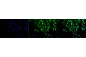 Immunocytochemistry/Immunofluorescence analysis using Rabbit Anti-Ubiquitin Polyclonal Antibody (ABIN361830 and ABIN361831). (Ubiquitin antibody)