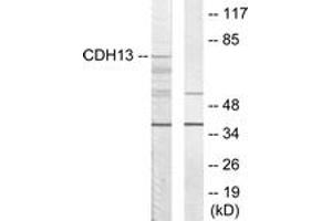 Western blot analysis of extracts from LOVO cells, using CDH13 Antibody.