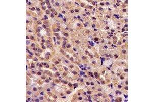 Immunohistochemical analysis of TGase5 staining in rat kidney formalin fixed paraffin embedded tissue section. (Transglutaminase 5 antibody)